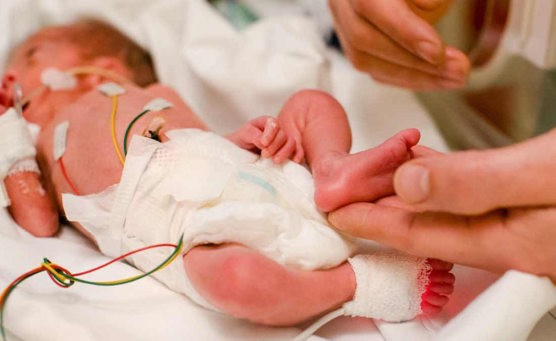 قشم بدون NICU/ جان نوزادان در جزیره قربانی کمبود امکانات درمانی