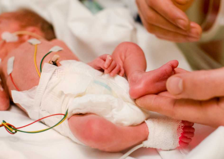 قشم بدون NICU/ جان نوزادان در جزیره قربانی کمبود امکانات درمانی