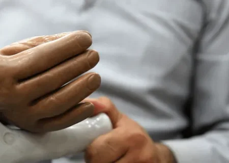 ۲ هزار و ۶۲۵ معلول قشمی زیر چتر حمایتی بهزیستی/ پرداخت مستمری به بیش از ۱۲۰۰ معلول